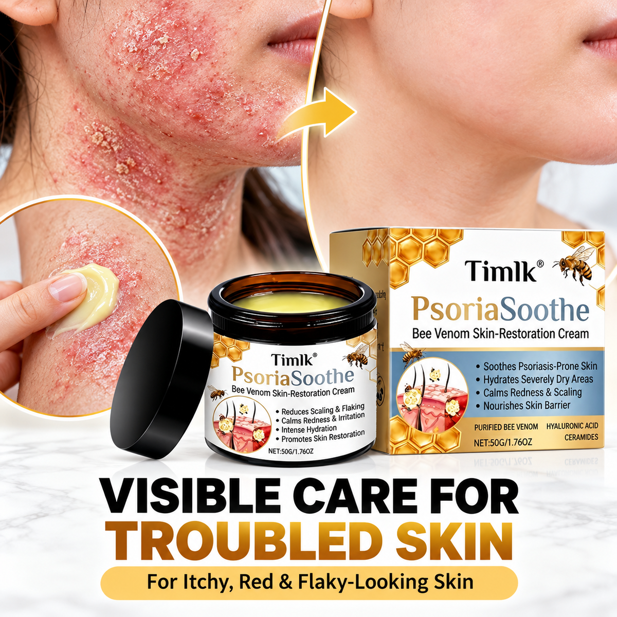 Timlk® PsoriaSoothe Bee Venom Skin-Restoration Cream