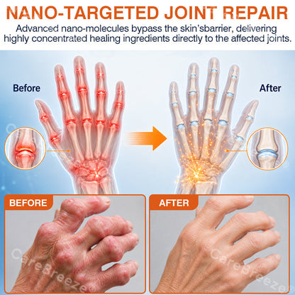 🦵✅Advanced Micro-Delivery Technology:CareBreeze® Pain-Relief Bone-Healing Microneedle Patch