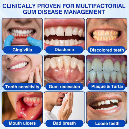 🔥LAST DAY 49% OFF - 🏅🦷🛡️Evolvion® GumRevive Periodontal Repair Gel