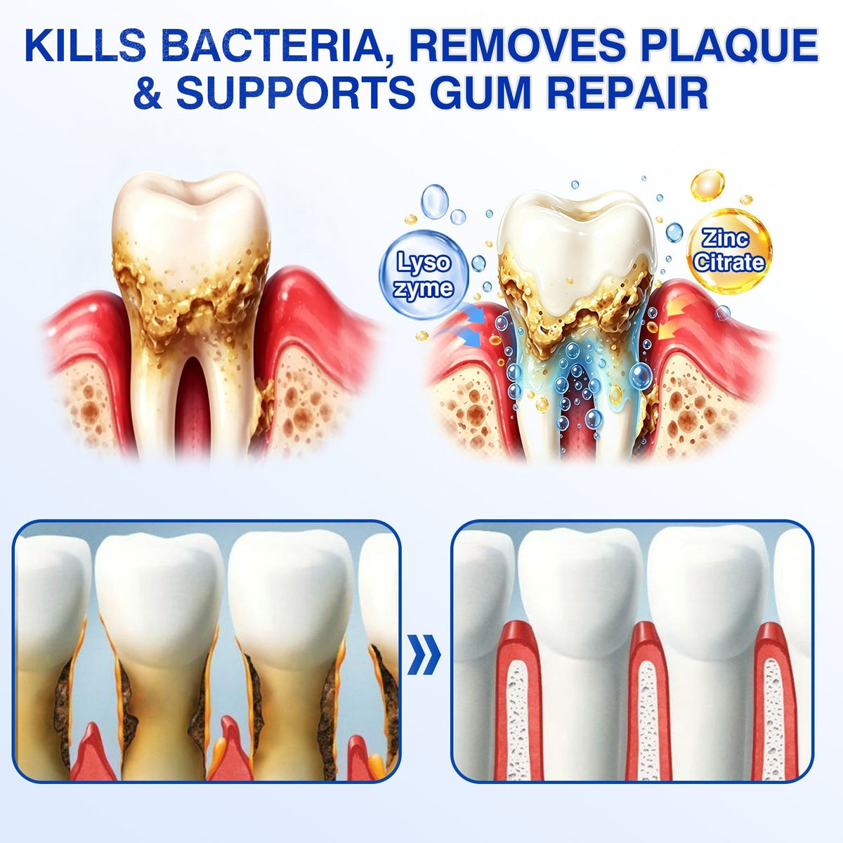 🔥LAST DAY 49% OFF - 🏅🦷🛡️Evolvion® GumRevive Periodontal Repair Gel