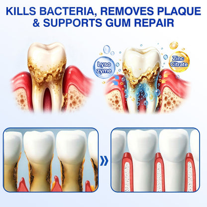🔥LAST DAY 49% OFF - 🏅🦷🛡️Evolvion® GumRevive Periodontal Repair Gel