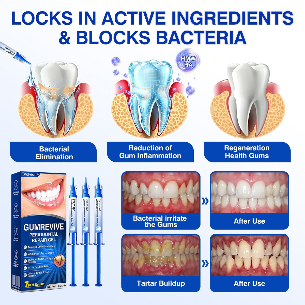 🔥LAST DAY 49% OFF - 🏅🦷🛡️Evolvion® GumRevive Periodontal Repair Gel
