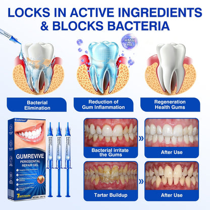 🔥LAST DAY 49% OFF - 🏅🦷🛡️Evolvion® GumRevive Periodontal Repair Gel