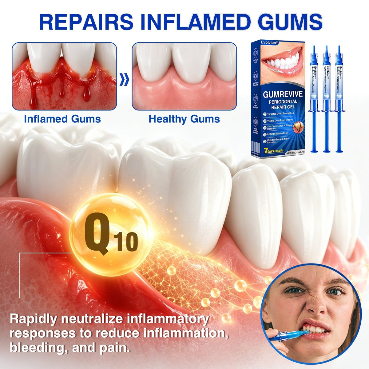 🔥LAST DAY 49% OFF - 🏅🦷🛡️Evolvion® GumRevive Periodontal Repair Gel