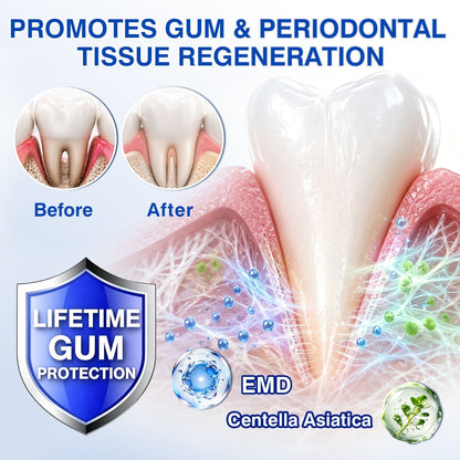🔥LAST DAY 49% OFF - 🏅🦷🛡️Evolvion® GumRevive Periodontal Repair Gel