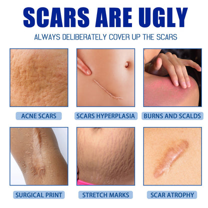✨Vivoshrine Scar Removal Cream , Skin Repair Gel for Surgical Scars, Acne Marks, Stretch Marks, Burn &amp; Cut Scars, Odorless Skin Care Cream for Adults &amp; Kids